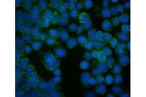IF analysis of FRMD6 using anti-FRMD6 antibody (ABIN7599577). (FRMD6 Antikörper  (AA 1-95))