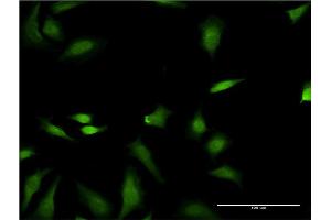 Immunofluorescence of monoclonal antibody to FNTB on HeLa cell. (FNTB Antikörper  (AA 1-437))