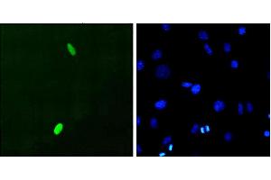 Immunocytochemistry/Immunofluorescence analysis using Mouse Anti-DUX4 Monoclonal Antibody, Clone P2B1 . (DUX4 Antikörper  (C-Term) (Atto 390))