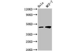 Western Blot Positive WB detected in: Hela whole cell lysate, MCF-7 whole cell lysate All lanes: TSG101 antibody at 1:500 Secondary Goat polyclonal to mouse IgG at 1/50000 dilution Predicted band size: 44, 32 KDa Observed band size: 44 KDa Exposure time:5 min (Tumor Suppressor Gene On Chromosome 11 (TSG11) (AA 1-145) Antikörper)