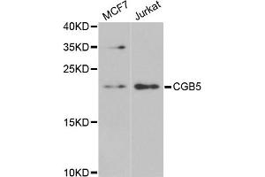 Western blot analysis of extracts of various cell lines, using CGB5 antibody.