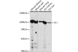 Western blot analysis of extracts of various cell lines, using VILL Rabbit pAb (ABIN7271325) at 1:1000 dilution.