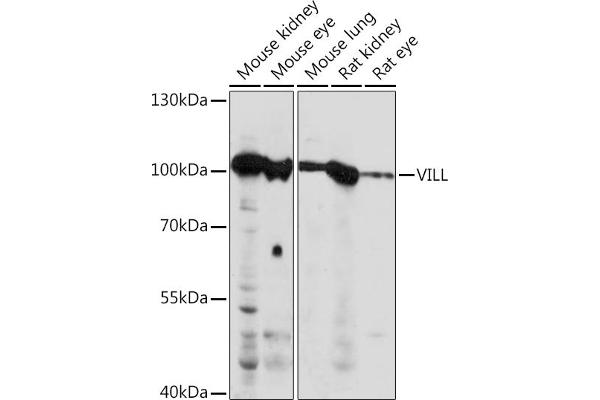 VILL antibody  (AA 637-856)