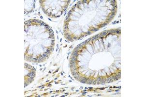 Immunohistochemistry of paraffin-embedded human colon using WNT9A antibody (ABIN5974646) at dilution of 1/100 (40x lens). (WNT9A Antikörper)