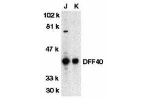 Western Blotting (WB) image for anti-DNA Fragmentation Factor, 40kDa, beta Polypeptide (Caspase-Activated DNase) (DFFB) (N-Term) antibody (ABIN1031351)
