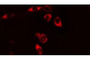 ABIN6269237 staining HeLa cells by IF/ICC. (CD130/gp130 Antikörper  (C-Term))