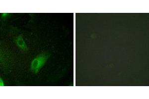 Peptide - +Immunohistochemistry analysis of paraffin-embedded human ovary tissue using IREB1 antibody. (Aconitase 1 Antikörper  (Internal Region))