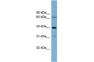 WB Suggested Anti-H2AFY2 Antibody Titration: 0. (H2AFY2 Antikörper  (Middle Region))