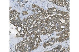 IHC analysis of RAB1B using anti-RAB1B antibody (ABIN7602809). (RAB1B Antikörper  (C-Term))