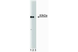 Western blot analysis of CaM Kinase IV on Jurkat lysate. (CAMK4 Antikörper  (AA 1-241))