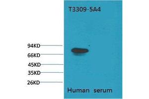 Western Blot (WB) analysis of Human Serum with Transferrin Mouse Monoclonal Antibody diluted at 1:2000. (Transferrin Antikörper)