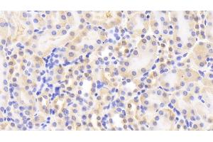 Detection of GR in Mouse Kidney Tissue using Polyclonal Antibody to Glutathione Reductase (GR) (Glutathione Reductase Antikörper  (AA 240-500))