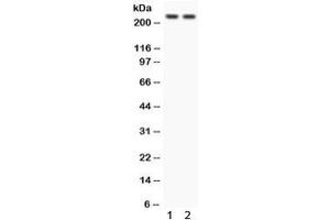 Western blot testing of 1) rat heart and 2) human 293 lysate with Otoferlin antibody. (Otoferlin Antikörper)