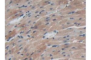 Immunohistochemistry (IHC) image for anti-Thioredoxin Reductase 1 (TXNRD1) (AA 374-577) antibody (ABIN7432433)