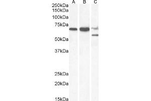 Western Blotting (WB) image for anti-Protein Phosphatase 2, Regulatory Subunit B', delta (PPP2R5D) (C-Term) antibody (ABIN184648)