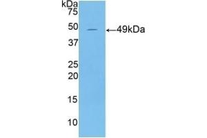 Detection of Recombinant KRT18, Mouse using Polyclonal Antibody to Cytokeratin 18 (CK18) (Cytokeratin 18 Antikörper  (AA 1-423))