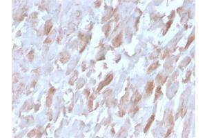 Formalin-fixed, paraffin-embedded human Cardiac Muscle stained with Sarcomeric Actinin Alpha 2 Mouse Monoclonal Antibody (ACTN2/3291). (ACTN2 Antikörper  (AA 557-692))