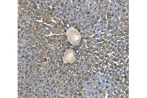 IHC analysis of Glycine decarboxylase/GLDC using anti-Glycine decarboxylase/GLDC antibody (ABIN7602073).