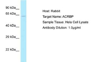 Host: Rabbit Target Name: ACRBP Sample Tissue: Human Hela Whole Cell Antibody Dilution: 1ug/ml (ACRBP Antikörper  (N-Term))