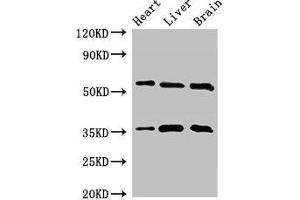 Western Blot Positive WB detected in: Mouse heart tissue, Mouse liver tissue, Mouse brain tissue All lanes: STK35 antibody at 2. (STK35 Antikörper  (AA 1-200))