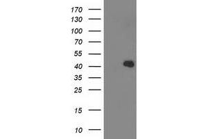 Western Blotting (WB) image for anti-Aldolase B, Fructose-Bisphosphate (ALDOB) antibody (ABIN1496607) (ALDOB Antikörper)