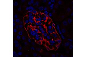 Immunostaining of a paraffin embedded mouse kidney section (dilution 1 : 200; red).