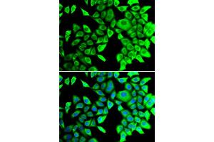 Immunofluorescence analysis of A549 cells using THADA antibody. (THADA Antikörper)