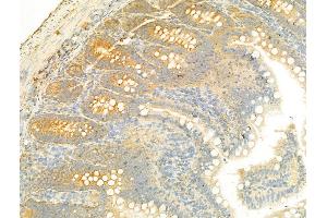 ABIN6265092 and ABIN6268681 at 1/100 staining Rat colon tissue by IHC-P.