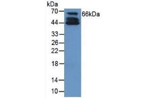 Detection of COL10 in Human Cartilage Tissue using Polyclonal Antibody to Collagen Type X (COL10) (COL10 Antikörper  (AA 547-680))