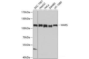 Western blot analysis of extracts of various cell lines using MARS Polyclonal Antibody at dilution of 1:1000. (Mars (MARS) Antikörper)