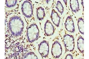 Immunohistochemistry of paraffin-embedded human colon tissue using ABIN7155860 at dilution of 1:100 (VENTX Antikörper  (AA 1-258))