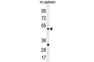 Western Blotting (WB) image for anti-TBC1 Domain Family, Member 13 (TBC1D13) (AA 83-113), (Middle Region) antibody (ABIN955091)