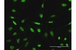 Immunofluorescence of purified MaxPab antibody to GTF3C2 on HeLa cell.
