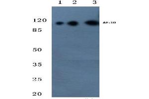 Western blot (WB) analysis of AF-10 antibody at 1/500 dilution. (MLLT10 Antikörper)