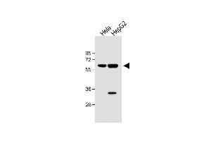All lanes : Anti-hIL1R-p at 1:1000 dilution Lane 1: Hela whole cell lysate Lane 2: HepG2 whole cell lysate Lysates/proteins at 40 μg per lane. (IL1R1 Antikörper  (C-Term))
