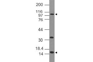 Image no. 1 for anti-DNA (Cytosine-5-)-Methyltransferase 3 alpha (DNMT3A) antibody (ABIN5027477) (DNMT3A Antikörper)