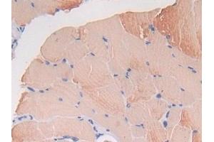 Immunohistochemistry (IHC) image for anti-Thioredoxin Interacting Protein (TXNIP) (AA 30-381) antibody (ABIN7433201)