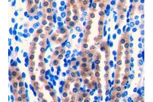 DAB staining on IHC-P; Samples: Mouse Kidney Tissue (FGF1 Antikörper  (AA 16-155))