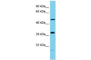 Host: Rabbit Target Name: C6orf211 Sample Type: MCF7 Whole Cell lysates Antibody Dilution: 1. (C6ORF211 Antikörper  (N-Term))