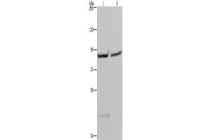 Western Blotting (WB) image for anti-Glycogen Synthase 1 (Muscle) (GYS1) antibody (ABIN2423549) (Glycogen Synthase 1 Antikörper)