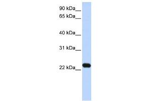 WB Suggested Anti-HBXIP Antibody Titration: 0.