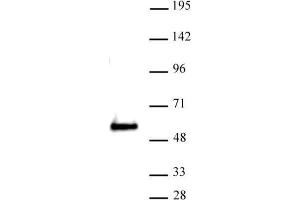 SMARCE1 antibody (pAb) tested by Western blot. (SMARCE1 Antikörper  (C-Term))