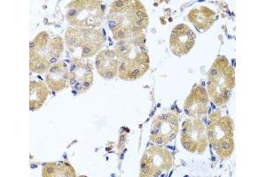 Immunohistochemistry of paraffin-embedded Human stomach using RHOB Polyclonal Antibody at dilution of 1:100 (40x lens).