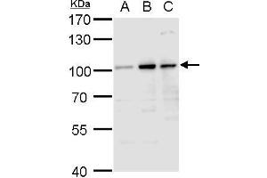 WB Image Aconitase 1 antibody detects Aconitase 1 protein by western blot analysis. (Aconitase 1 Antikörper)