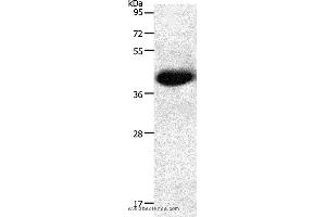Western blot analysis of Mouse heart tissue, using NGFR Polyclonal Antibody at dilution of 1:950 (NGFR Antikörper)