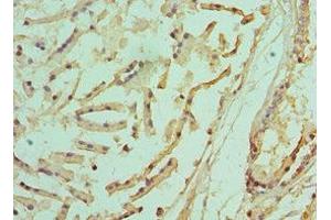 Immunohistochemistry of paraffin-embedded human prostate tissue using ABIN7142216 at dilution of 1:100 (PSMD5 Antikörper  (Regulatory Subunit 5))