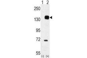 Western blot analysis of TIE2 antibody and 293 cell lysate either nontransfected (Lane 1) or transiently transfected with the TEK gene (2). (TEK Antikörper  (AA 758-789))