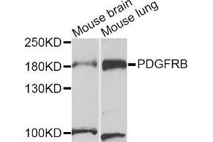 Western blot analysis of extracts of mouse brain and mouse lung cell lines, using PDGFRB antibody. (PDGFRB Antikörper)