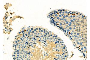 ABIN6264707 and ABIN6266720 at 1/100 staining Mouse testis tissue by IHC-P.