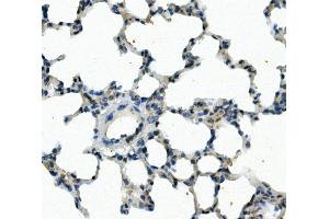 IHC analysis of FOXF1 using anti-FOXF1 antibody (ABIN7601744). (FOXF1 Antikörper  (AA 44-379))